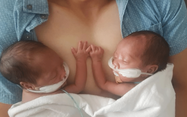 Fetițe gemene, născute prematur, se îmbrățișează la prima întâlnire după ieșirea din burtică | Demamici.ro
