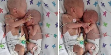 Miracolele există. Medicii nu i-au dat nicio șansă la viață, însă surioara mai mică a luptat și a supraviețuit. Momentul emoționant în care și-a îmbrățișat fratele geamăn | Demamici.ro