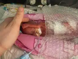 Cântărea doar 325 de grame la naștere și încăpea în palma mamei. Cel mai mic bebeluș care s-a născut prematur în Marea Britanie | Demamici.ro