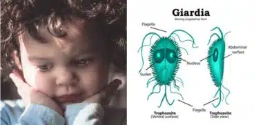 Giardioza (infecția cu giardia). Parazitoza intestinală care dă bătăi de cap părinților | Demamici.ro
