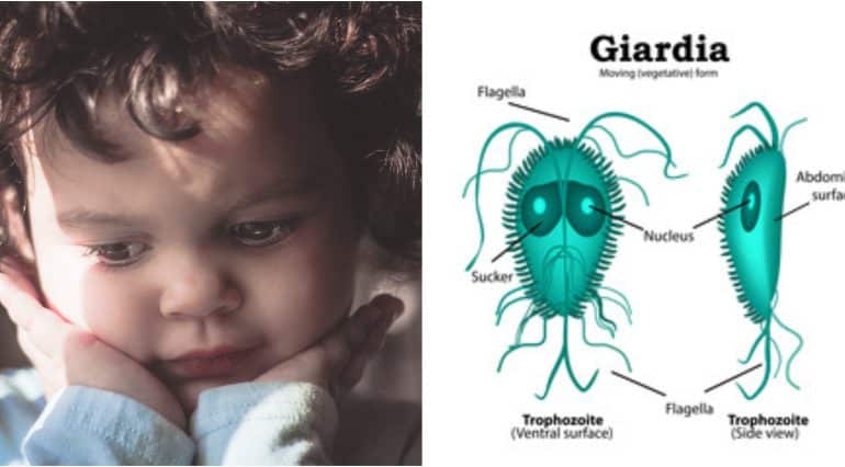 Giardioza (infecția cu giardia). Parazitoza intestinală care dă bătăi de cap părinților | Demamici.ro