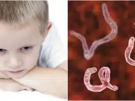 Ascaridioza (limbricii). Cum tratezi şi previi una dintre cele mai frecvente probleme ale copilăriei | Demamici.ro