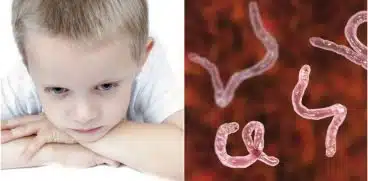 Ascaridioza (limbricii). Cum tratezi şi previi una dintre cele mai frecvente probleme ale copilăriei | Demamici.ro