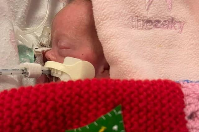 O mamă a născut prematur un bebeluș supraviețuitor de doar 425 de grame: "Era de dimensiunea unui biscuite de Crăciun"