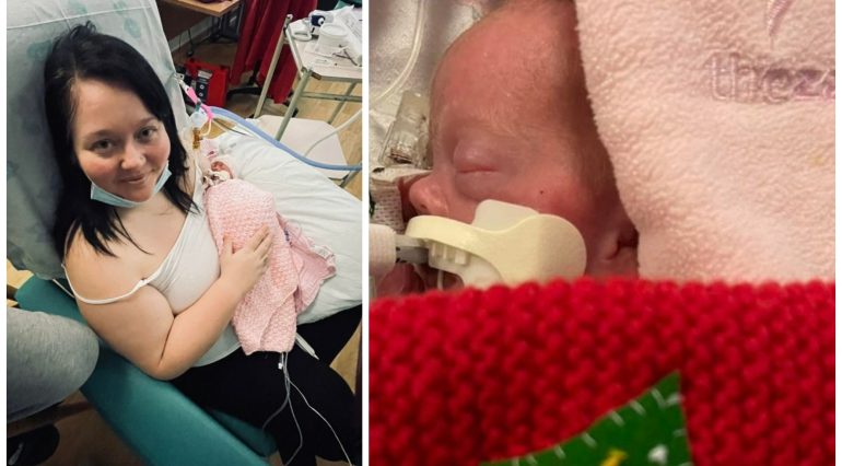 O mamă a născut prematur un bebeluș supraviețuitor de doar 425 de grame: 