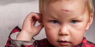 Loviturile la cap ale copilului! Măsuri de prim ajutor și când trebuie să suni la medic | Demamici.ro