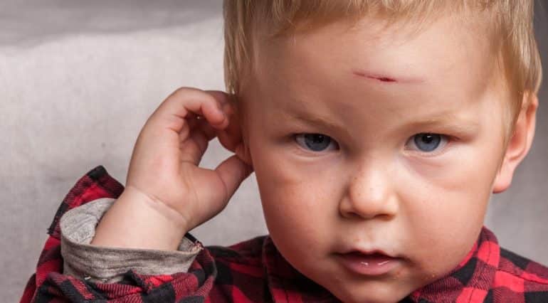 Loviturile la cap ale copilului! Măsuri de prim ajutor și când trebuie să suni la medic | Demamici.ro