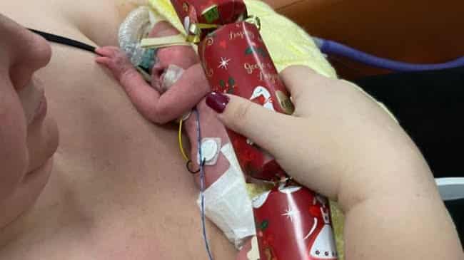 O mamă a născut prematur un bebeluș supraviețuitor de doar 425 de grame: "Era de dimensiunea unui biscuite de Crăciun"