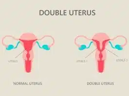 Uterul didelf sau uterul dublu. Cum afectează sarcina | Demamici.ro