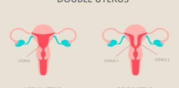 Uterul didelf sau uterul dublu. Cum afectează sarcina | Demamici.ro