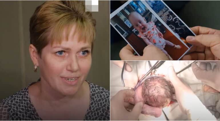 O femeie de 40 de ani cu sarcină extrauterină a născut purtând bebelușul în cavitatea abdominală | Demamici.ro