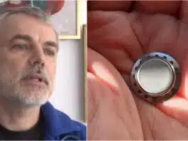 Dr. Mihai Craiu, despre pericolul bateriilor buton. Ce putem face până ajungem cu copilul la spital | Demamici.ro