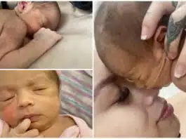 „Micuța maimuțică”. O fetiță s-a născut cu păr negru pe tot corpul și a primit o poreclă specială. Afecțiunea are legătură cu nașterea prematură | Demamici.ro