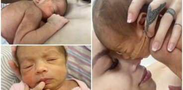 „Micuța maimuțică”. O fetiță s-a născut cu păr negru pe tot corpul și a primit o poreclă specială. Afecțiunea are legătură cu nașterea prematură | Demamici.ro