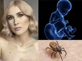 Borelioza (Boala Lyme), boala de care suferă Adda, se transmite de la mamă la făt: „Nu e de la căpușă. O are și mama” | Demamici.ro
