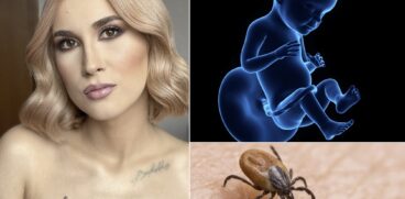 Borelioza (Boala Lyme), boala de care suferă Adda, se transmite de la mamă la făt: „Nu e de la căpușă. O are și mama” | Demamici.ro