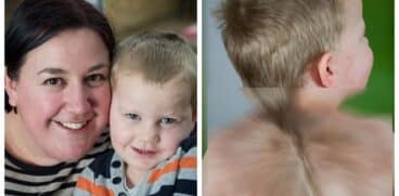 Băieţelul care s-a născut cu „aripi”. Părinții îl consideră un înger | Demamici.ro