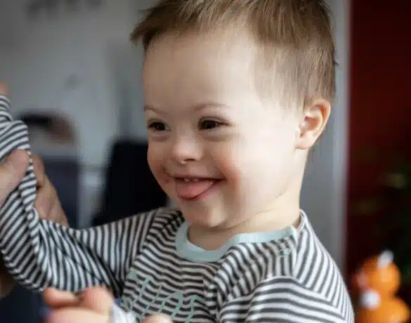 Sindromul Down: cauze, simptome și tratament | Demamici.ro