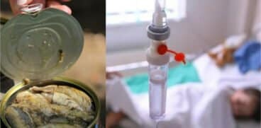 O fetiță de 7 ani din Suceava a ajuns la Urgențe cu botulism după ce a mâncat o conservă | Demamici.ro