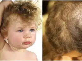 Copilul își smulge părul fără un motiv aparent? Sfaturi care vă pot ajuta | Demamici.ro