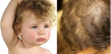 Copilul își smulge părul fără un motiv aparent? Sfaturi care vă pot ajuta | Demamici.ro