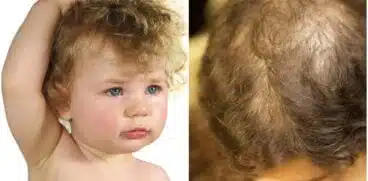 Copilul își smulge părul fără un motiv aparent? Sfaturi care vă pot ajuta | Demamici.ro