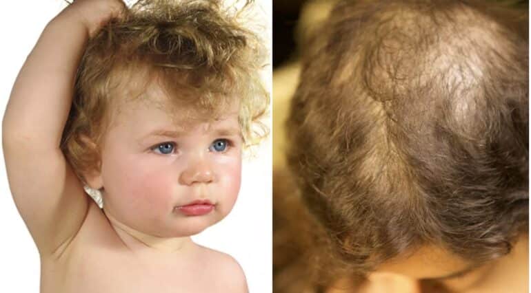 Copilul își smulge părul fără un motiv aparent? Sfaturi care vă pot ajuta | Demamici.ro