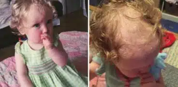 O fetiță de 2 ani își smulge părul din cap. Mama a decis să o tundă scurt: „Am încercat de toate ca să o opresc” | Demamici.ro