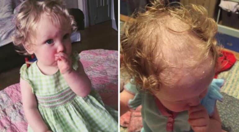 O fetiță de 2 ani își smulge părul din cap. Mama a decis să o tundă scurt: „Am încercat de toate ca să o opresc” | Demamici.ro