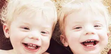 Totul despre albinism la copii: Cauze, simptome și tratament | Demamici.ro