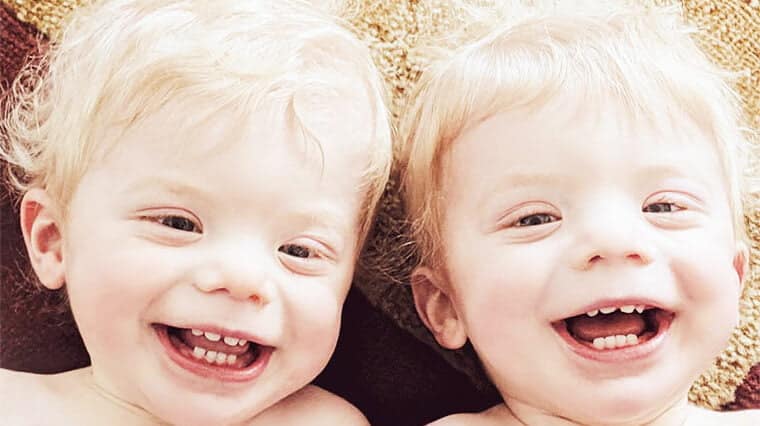 Totul despre albinism la copii: Cauze, simptome și tratament | Demamici.ro