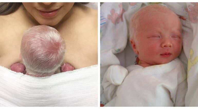O mamă a născut un bebeluș cu părul complet alb: „Știam că bebelușii noștri aveau șanse de 25% să se nască cu albinism” | Demamici.ro
