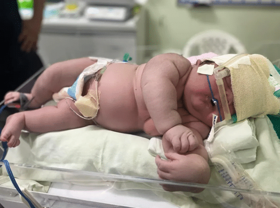 O femeie din Brazilia a născut un bebeluș de 7,3 kilograme. Mama mai are acasă alți cinci copii | Demamici.ro
