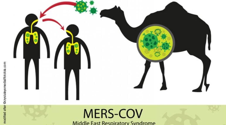 Gripa cămilei sau virusul MERS: simptome, cauze și tratament | Demamici.ro