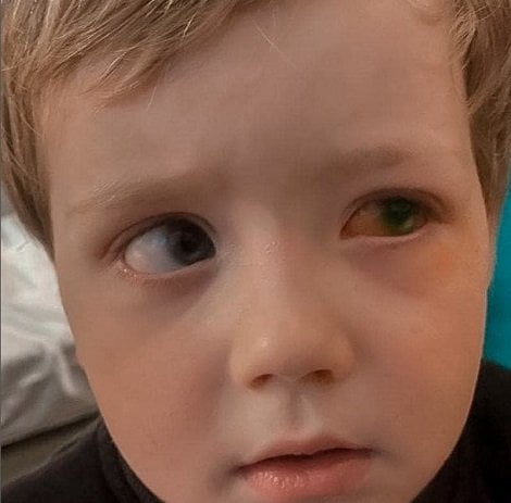 Când gelul dezinfectant ajunge de pe mâini în ochi. Un copil de 3 ani a făcut infecție la ochi: "Nu putea deschide ochiul, era inflamat"