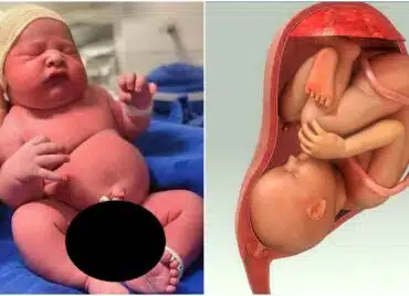 Macrosomia fetală – ce este și cum se manifestă | Demamici.ro