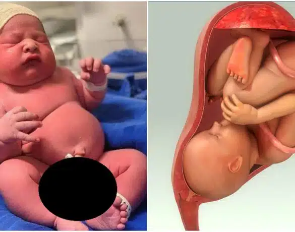 Macrosomia fetală – ce este și cum se manifestă | Demamici.ro