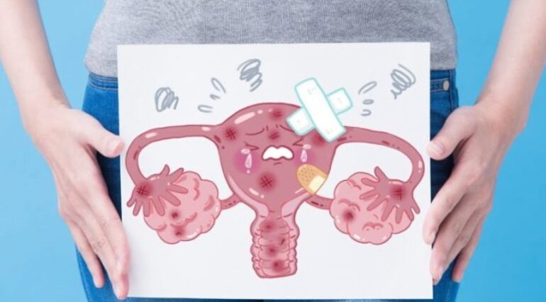 Endometrita: cauze, simptome și tratament | Demamici.ro