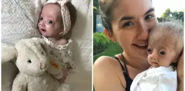 Lecția de viață a fetiței care s-a născut cu progeria, „boala bătrâneții”: „Am știut imediat că e altfel decât ceilalți bebeluși” | Demamici.ro