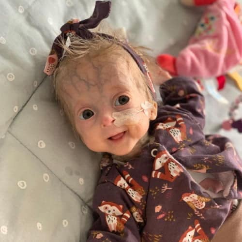 Lecția de viață a fetiței care s-a născut cu progeria, "boala bătrâneții": "Am știut imediat că e altfel decât ceilalți bebeluși"
