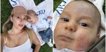 Băiețelul lui Emily Burghelea are probleme cu pielea: „Cine și-ar fi închipuit că dermatita atopică poate să fie atât de grea?” | Demamici.ro