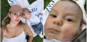 Băiețelul lui Emily Burghelea are probleme cu pielea: „Cine și-ar fi închipuit că dermatita atopică poate să fie atât de grea?” | Demamici.ro