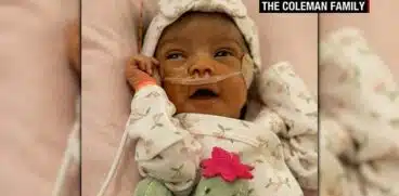 Prima operație pe creier reușită la un bebeluș aflat în burta mamei. Fetița a primit o nouă șansă și s-a născut fără defecte congenitale | Demamici.ro