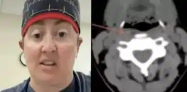 Un copil de 4 ani a ajuns la Urgențe cu o durere severă de ureche, după un grătar în familie | Demamici.ro