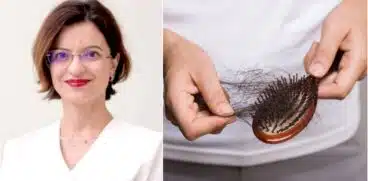 Căderea părului după naștere. Cauze și soluții prezentate de Dr. Oana Firescu, Medic primar Dermato-venerologie VIDEO (P) | Demamici.ro