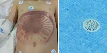 Un băiețel a fost salvat în ultimul moment după ce a fost aspirat de scurgerea din piscină | Demamici.ro