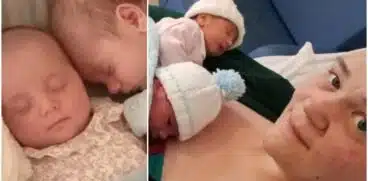 Caz extrem de rar: o mămică a născut gemeni chiar în același moment | Demamici.ro