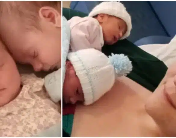 Caz extrem de rar: o mămică a născut gemeni chiar în același moment | Demamici.ro
