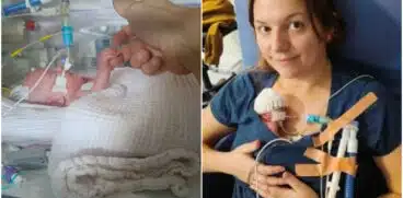 328 de grame de viață: „Ne-au spus că e cel mai mic bebeluș născut din țară”. Fetița s-a luptat cu o forță de fier să trăiască | Demamici.ro