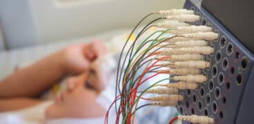 Sindromul Dravet la copii: cauze, simptome și tratament | Demamici.ro